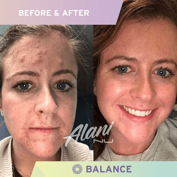 Alani Nu - NutraStop